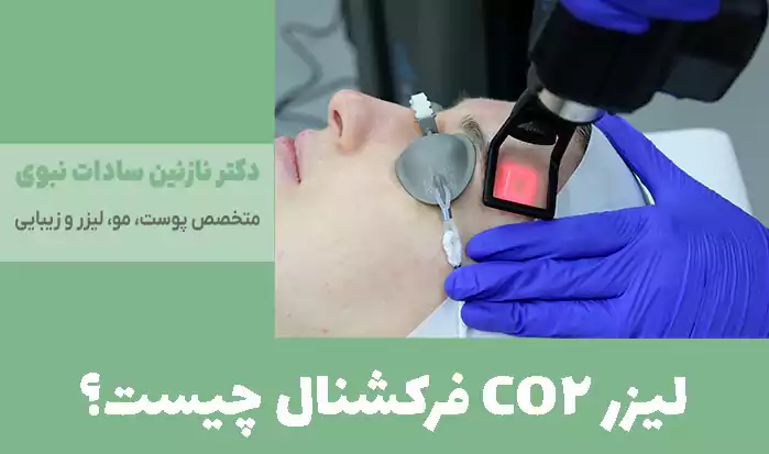 لیزر CO2 فرکشنال چیست؟