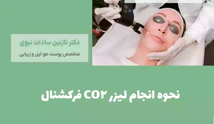 نحوه انجام لیزر CO2 فرکشنال