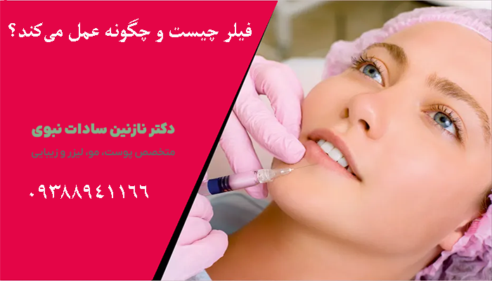 فیلر چیست و چگونه عمل می‌کند؟