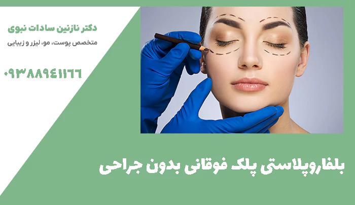 بلفاروپلاستی پلک فوقانی بدون جراحی