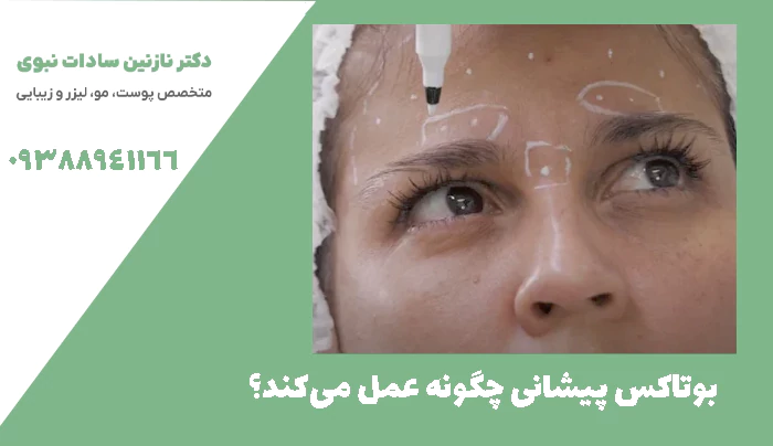 بوتاکس پیشانی چگونه عمل می‌کند؟