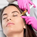 تزریق پی آر پی (PRP)