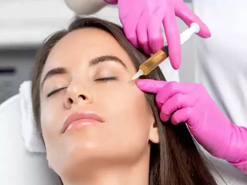 تزریق پی آر پی (PRP)