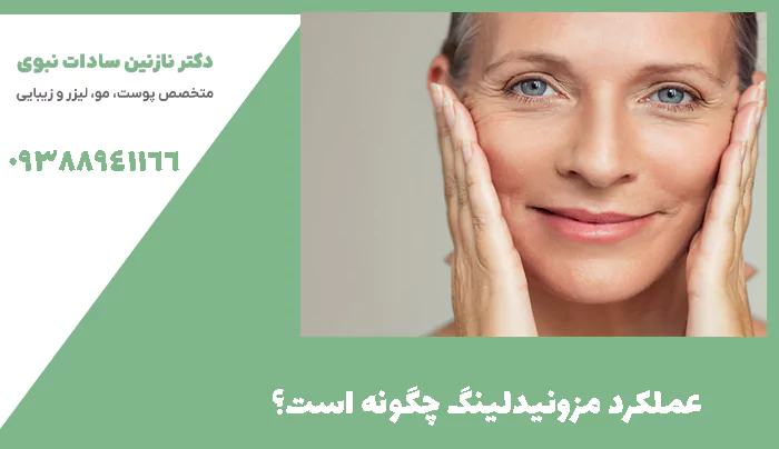 عملکرد مزونیدلینگ چگونه است؟