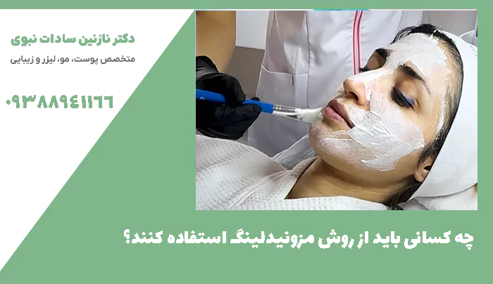 چه کسانی باید از روش مزونیدلینگ استفاده کنند؟