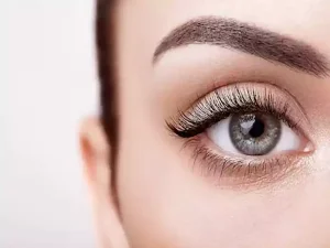 بوتاکس چشم گربه ای
