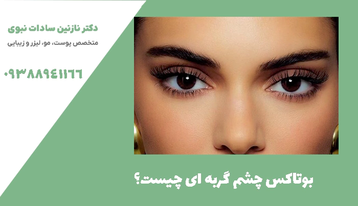 بوتاکس چشم گربه ای چیست؟