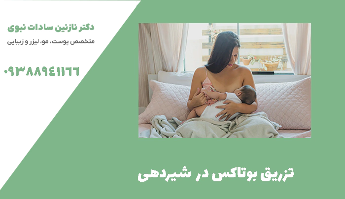 تزریق بوتاکس در  شیردهی