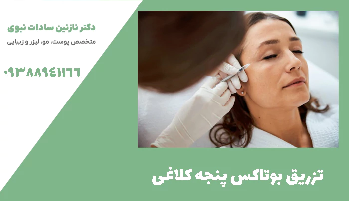 تزریق بوتاکس پنجه کلاغی