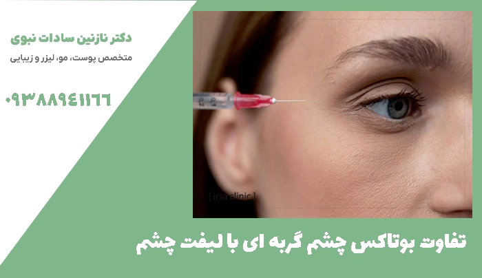 تفاوت بوتاکس چشم گربه ای با لیفت چشم