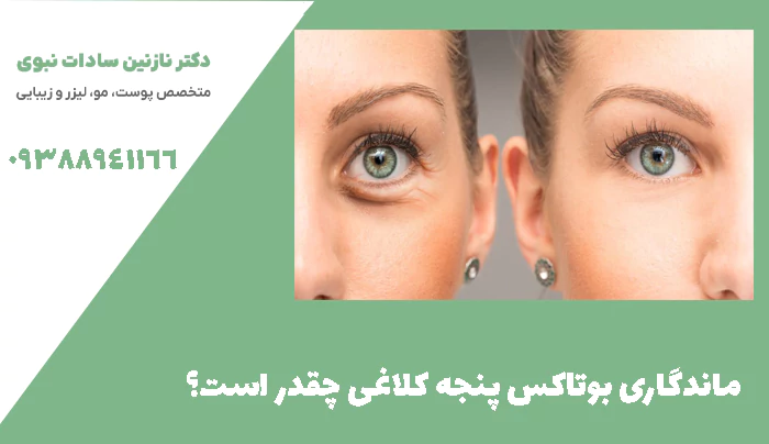 ماندگاری بوتاکس پنجه کلاغی چقدر است؟