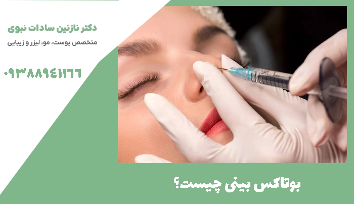 بوتاکس بینی چیست؟