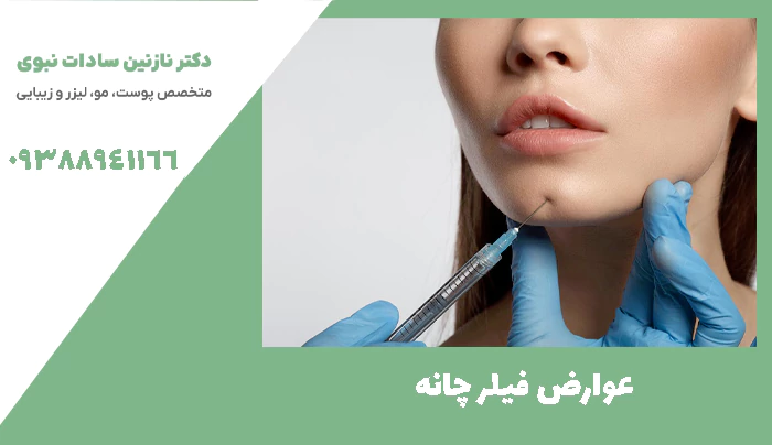 عوارض فیلر چانه