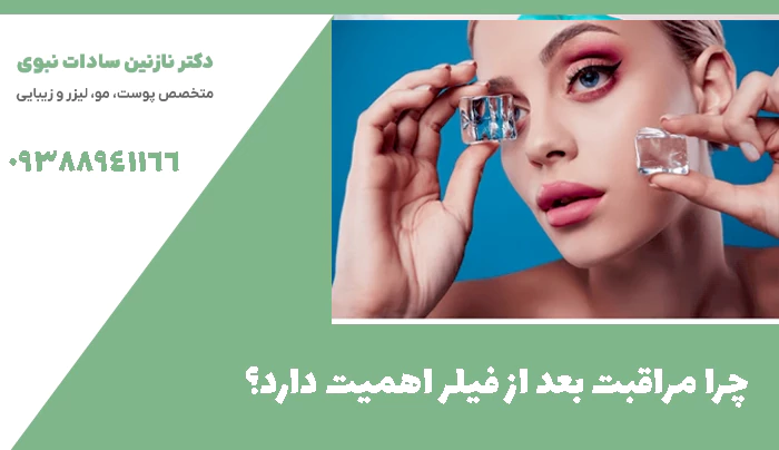 چرا مراقبت بعد از فیلر اهمیت دارد؟