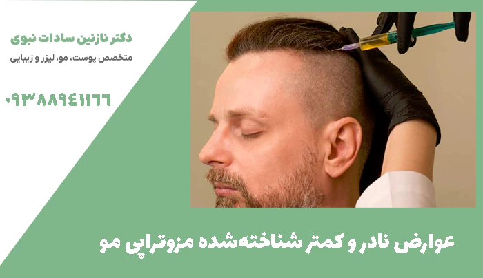 عوارض نادر و کمتر شناخته‌شده مزوتراپی مو