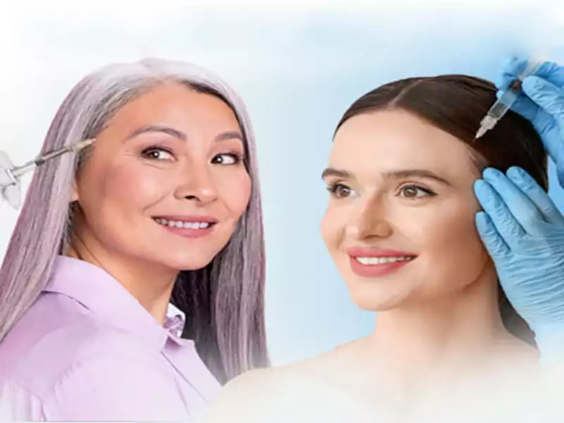 سن مناسب برای مزوتراپی مو چه سنی است